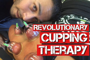 Revolutionary Myofascial Decompression: Cupping Therapy