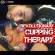 Revolutionary Myofascial Decompression: Cupping Therapy