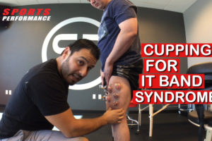 Cupping Therapy For IT Band Syndrome