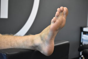 What To Do After An Ankle Sprain