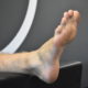 What To Do After An Ankle Sprain