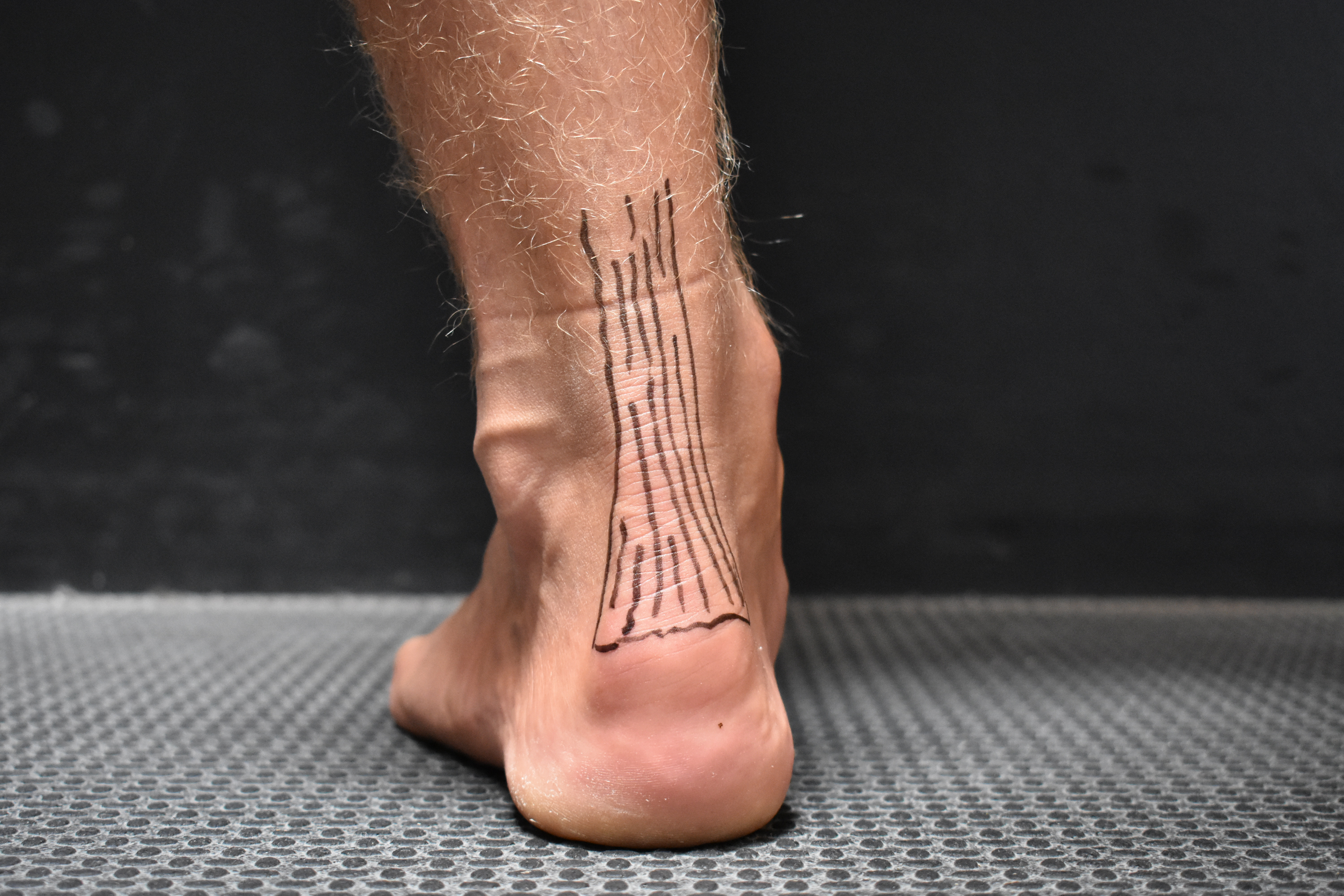 Achilles Tendinitis Rehabilitation Exercises