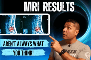 MRI Results Aren’t Always What You Think! Do You Really Need One?
