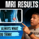 MRI Results Aren’t Always What You Think! Do You Really Need One?