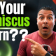 Is It Really a Meniscus Tear? Here’s How to Tell.